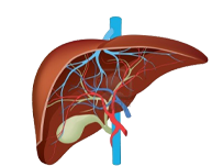 Liver-Cirrhosis